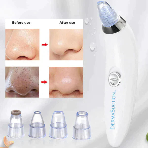 4 IN 1 Derma Suction Blackheads Remover